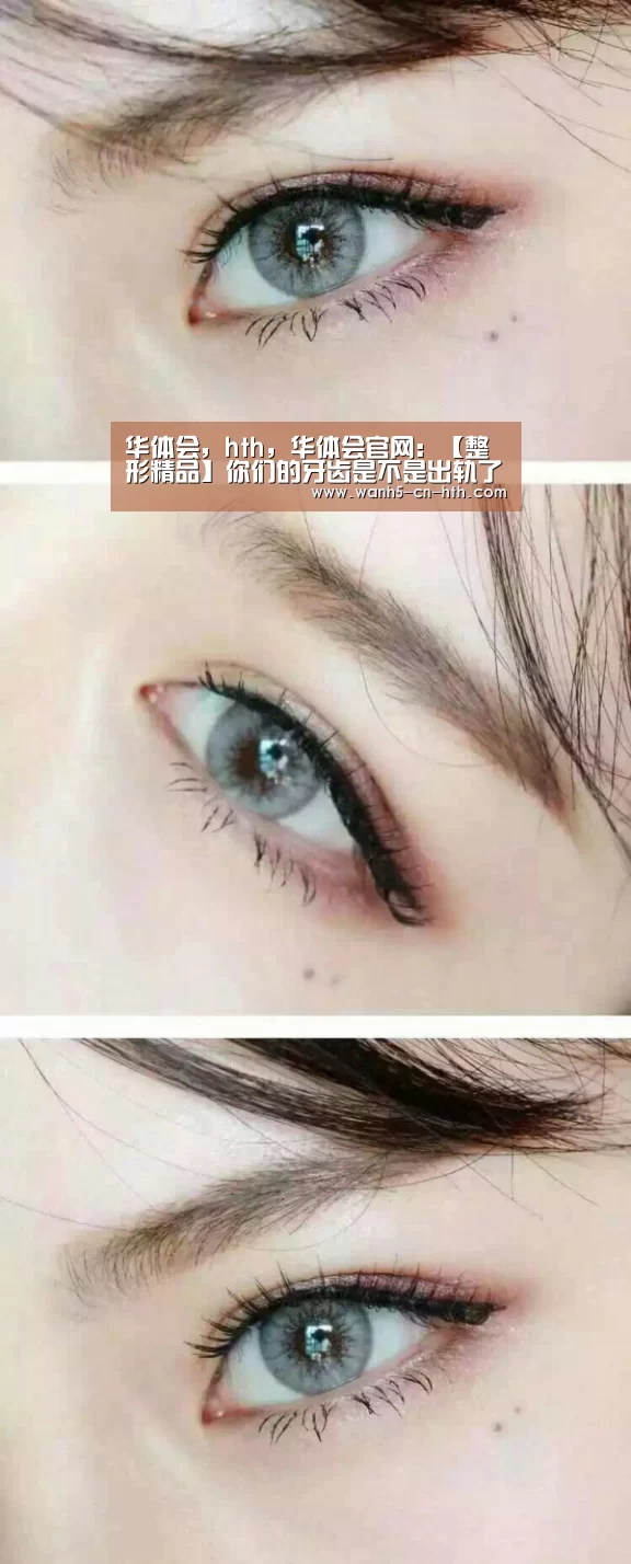 华体会,hth,华体会官网:【整形精品】你们的牙齿是不是出轨了(图3) 华体会,hth,华体会官网